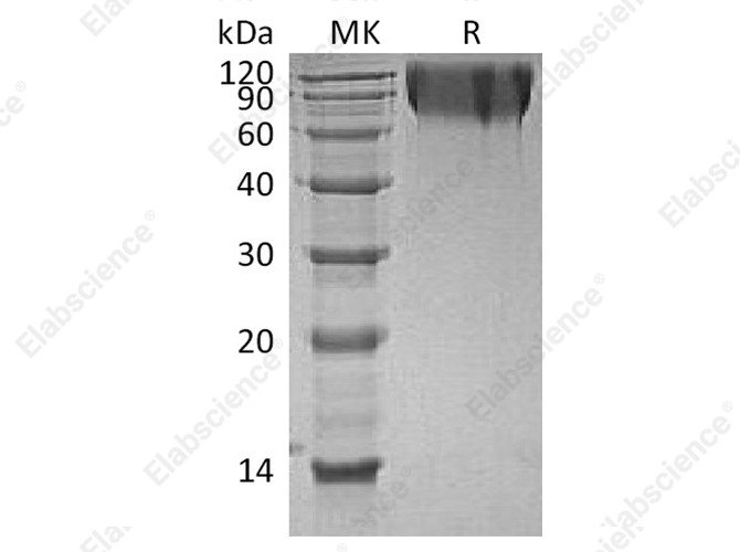 Recombinant Human CEACAM1/CD66a Protein (His Tag) - 1