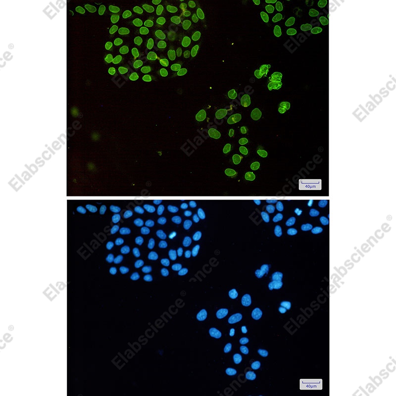 Recombinant Emerin Monoclonal Antibody - 2