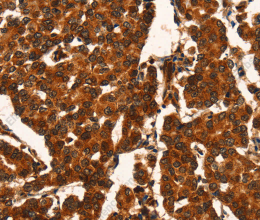 CUEDC2 Polyclonal Antibody - 2