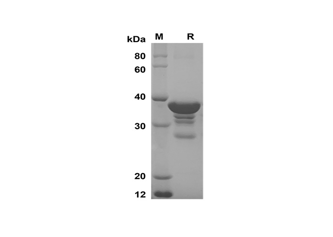 Recombinant Human CXCL1 Protein(GST Tag)-1