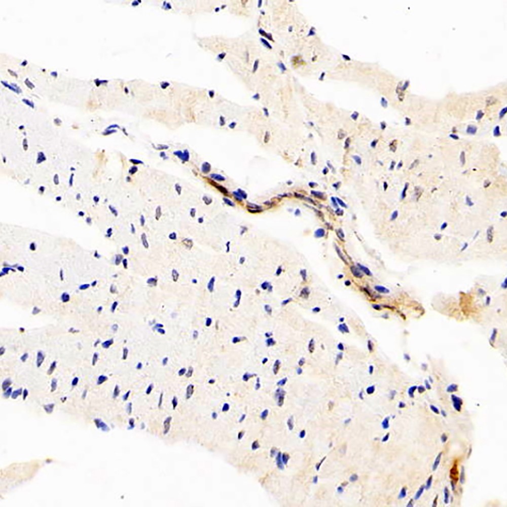 Immunohistochemistry analysis of paraffin-embedded rat heart  using DLL4 Polyclonal Antibody at dilution of 1:200.