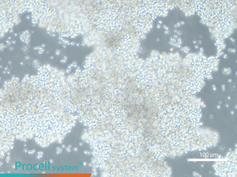 NCI-H2171NCI-H2171 - 3