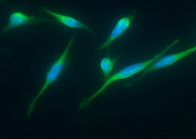 ITCH/AIP4 Monoclonal Antibody - small - 2