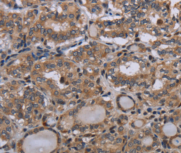 P2RX2 Polyclonal Antibody - 2