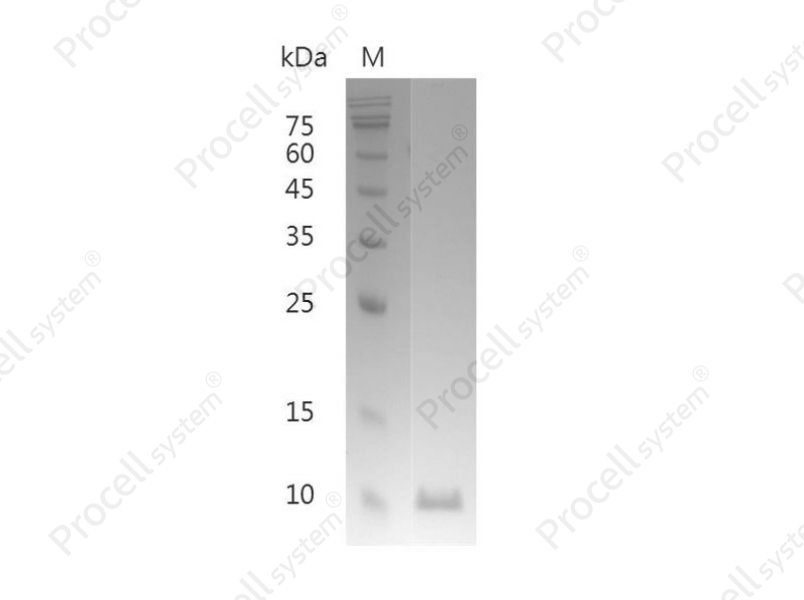 MIF/GLIF/GIF, Human, Recombinant