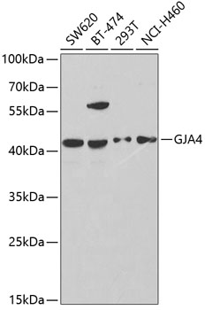 Western blot analysis of extracts of various cell lines using GJA4 Polyclonal Antibody at dilution of 1:1000.