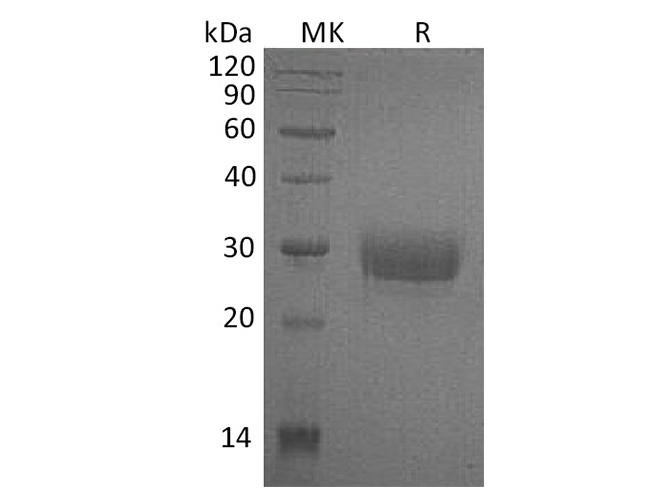 Recombinant Human CD32a/FCGR2A Protein (H131, His Tag)(Active)