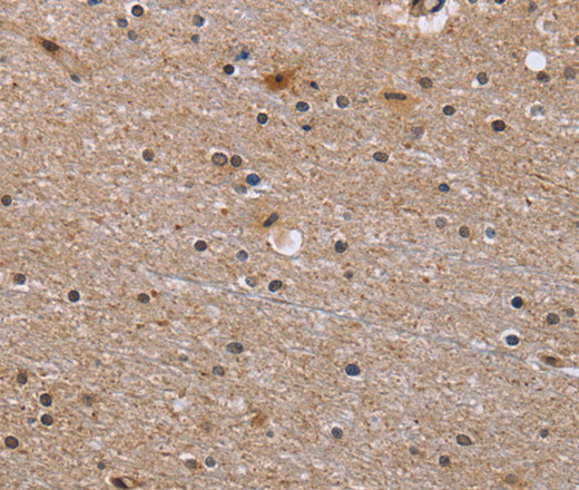 Immunohistochemistry of paraffin-embedded Human brain  tissue using GABPB2 Polyclonal Antibody at dilution 1:30