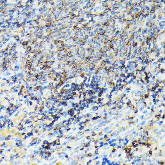 Immunohistochemistry of paraffin-embedded rat spleen using CORO1A Polyclonal Antibody at dilution of 1:100 (40x lens).Perform high pressure antigen retrieval with 10 mM citrate buffer pH 6.0 before commencing with IHC staining protocol.