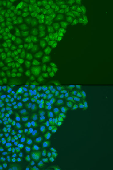 Immunofluorescence analysis of U2OS cells using DAPK2 Polyclonal Antibody at dilution of  1:100. Blue: DAPI for nuclear staining.