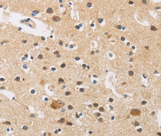 Immunohistochemistry of paraffin-embedded Human brain tissue using FASTK Polyclonal Antibody at dilution 1:30