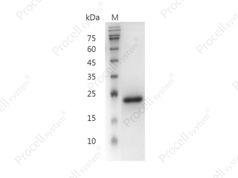 IL-6/IFN-&beta;2/BSF-2/HPGF/HSF, Mouse, Recombinant