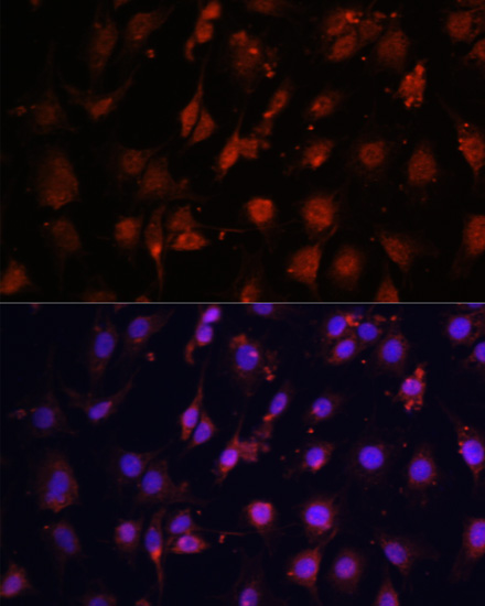 Immunofluorescence analysis of C6 cells using TET3 Polyclonal Antibody at dilution of  1:100. Blue: DAPI for nuclear staining.