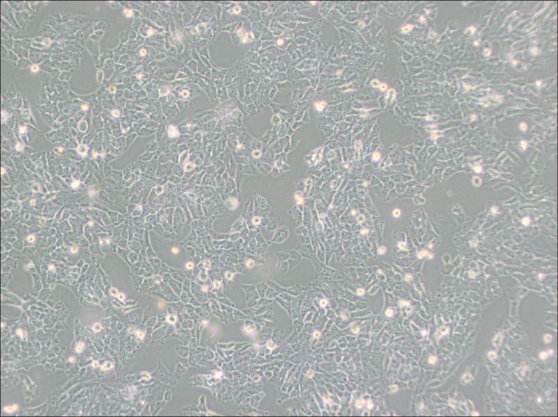 SK-N-AS Cell Complete Medium - 3