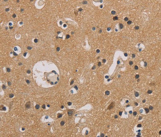 Immunohistochemistry of paraffin-embedded Human brain  tissue using ITGB3BP Polyclonal Antibody at dilution 1:50