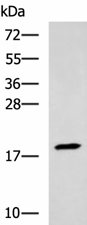 Western blot analysis of Human muscle tissue lysate  using TNNC2 Polyclonal Antibody at dilution of 1:400