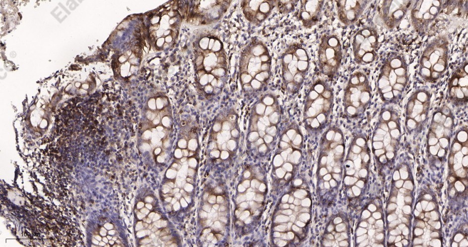 Recombinant CD8 α Monoclonal Antibody - 2