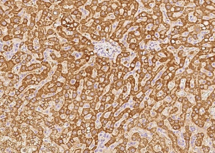 Recombinant GCSH Monoclonal Antibody - small - 2