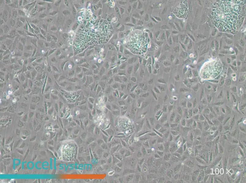 TR-LCC-1 Cell Complete MediumTR-LCC-1 Cell Complete Medium - 2