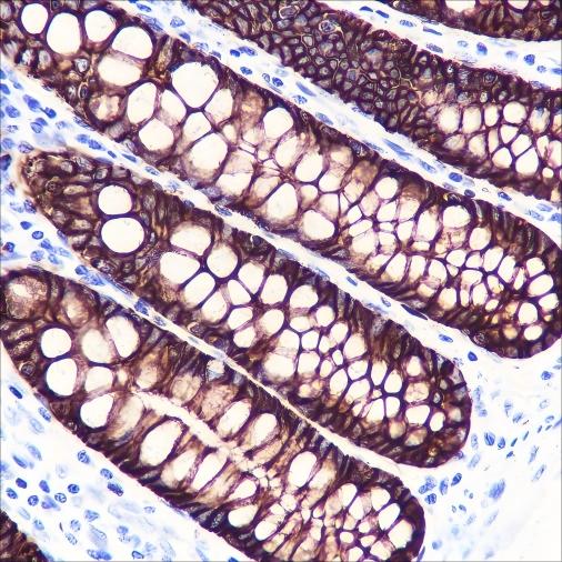 Recombinant GPA33 Monoclonal Antibody - small - 2