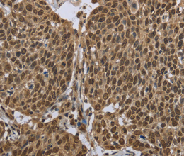 PPAT Polyclonal Antibody - 2