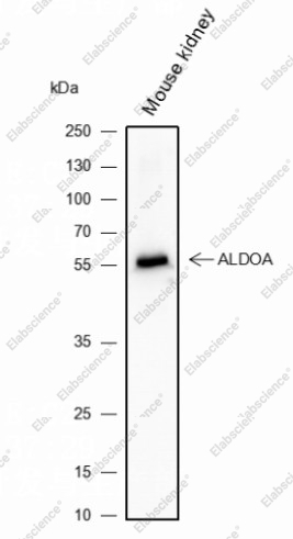 Recombinant Activin A Receptor Type IB/ALK-4 Monoclonal Antibody - 2