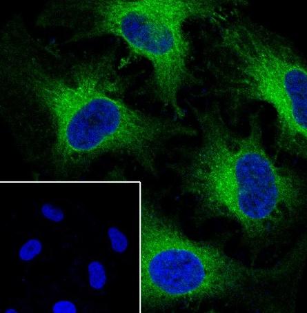 Recombinant RAP1A+RAP1B Monoclonal Antibody-searchlist-2