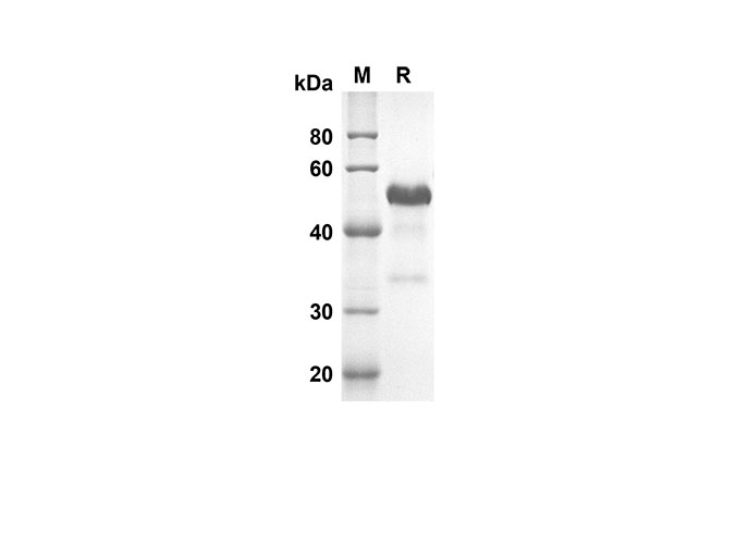 Recombinant Mouse CD38/ADPRC1 Protein(His Tag)-产品推荐-1