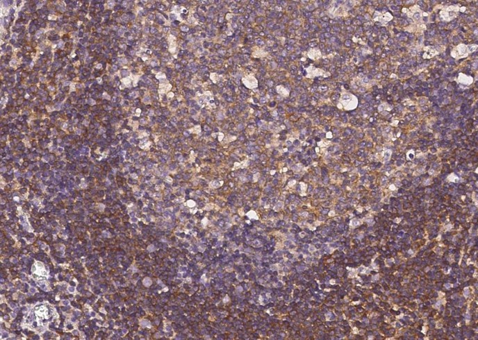 ERN1/IRE1 Monoclonal Antibody-searchlist-1