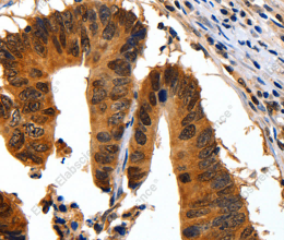 14-3-3 beta/alpha Polyclonal Antibody - 3