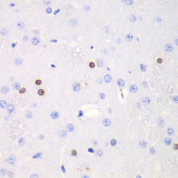Immunohistochemistry of paraffin-embedded Rat brain using TKT Polyclonal Antibody at dilution of 1:100 (40x lens).