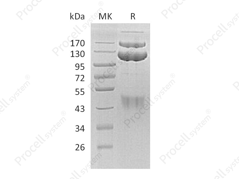 HGF R/c-Met/HGFR (C-Fc), Human, Recombinant