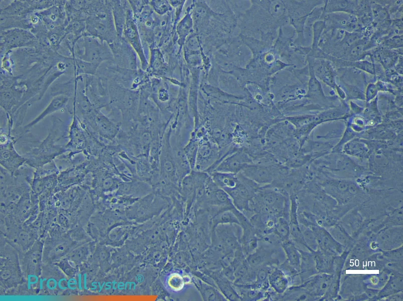 Rat Pulmonary Artery Fibroblast Complete Medium - 4
