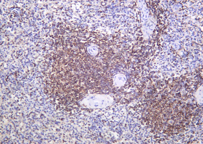 Recombinant Bcl-2 Monoclonal Antibody - 2