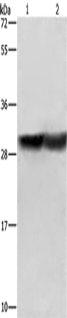 Western Blot analysis of Human fetal brain and Mouse kidney tissue   using CALB1 Polyclonal Antibody at dilution of 1:600