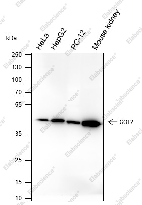 Recombinant GOT2 Monoclonal Antibody - 1