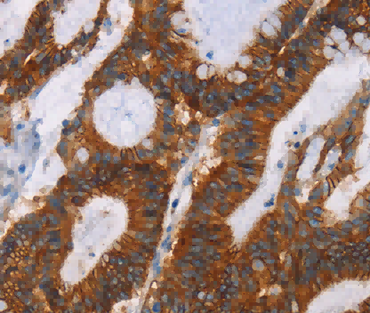 GPA33 Polyclonal Antibody - 2