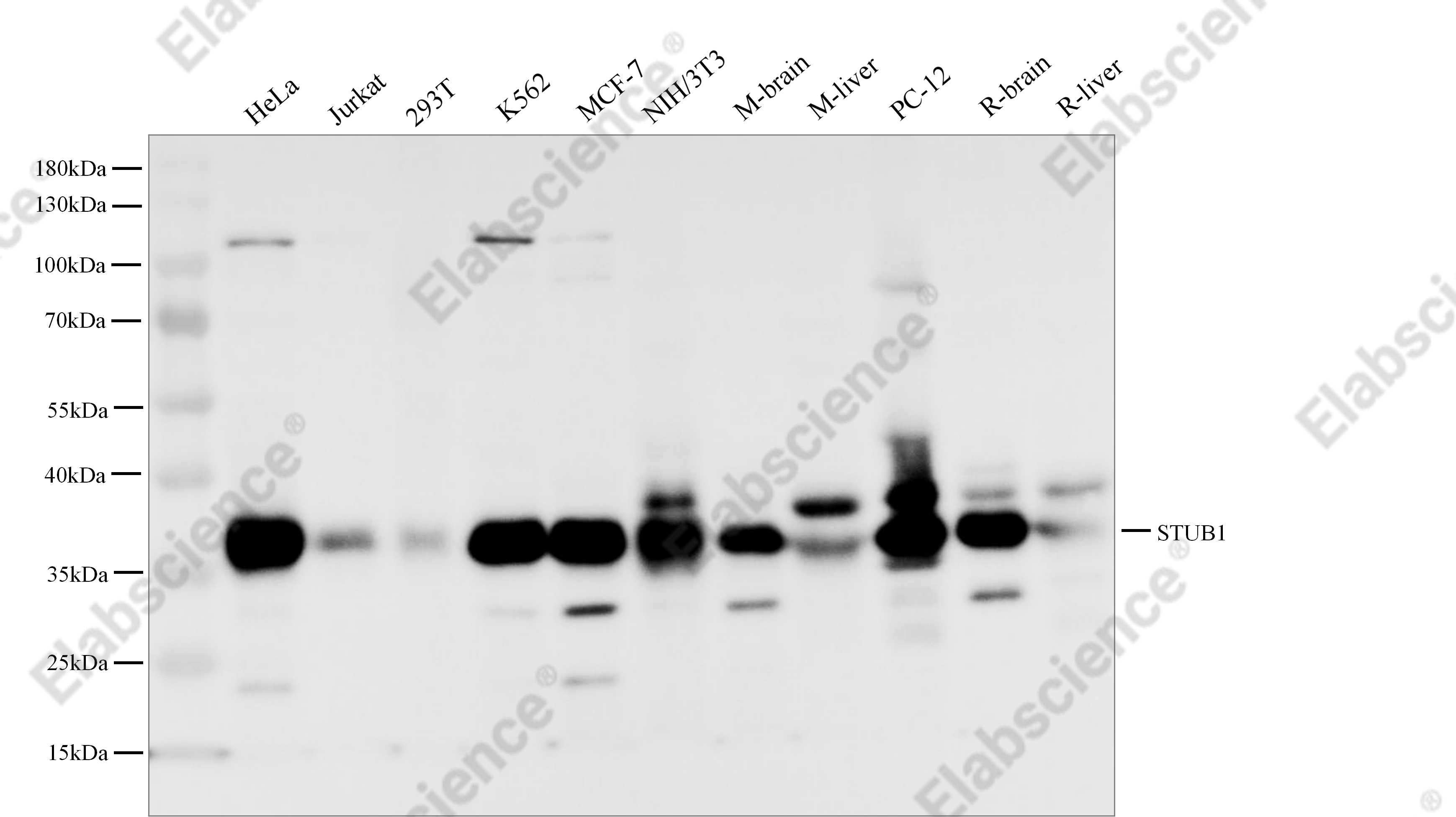 Recombinant STUB1 Monoclonal Antibody - 1
