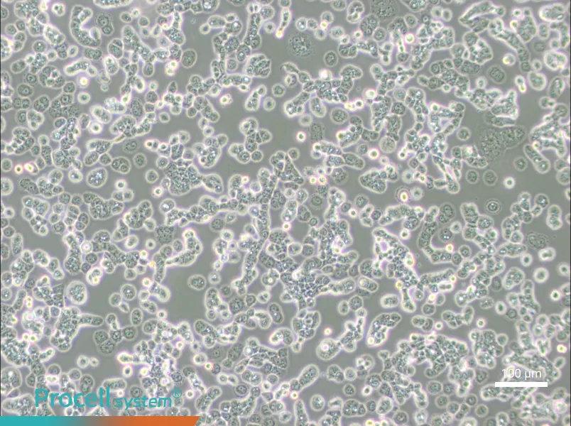 NCI-H2087 [H2087]NCI-H2087 [H2087] - 2