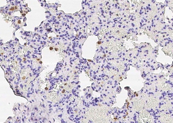 Recombinant CD68 Monoclonal Antibody-searchlist-1