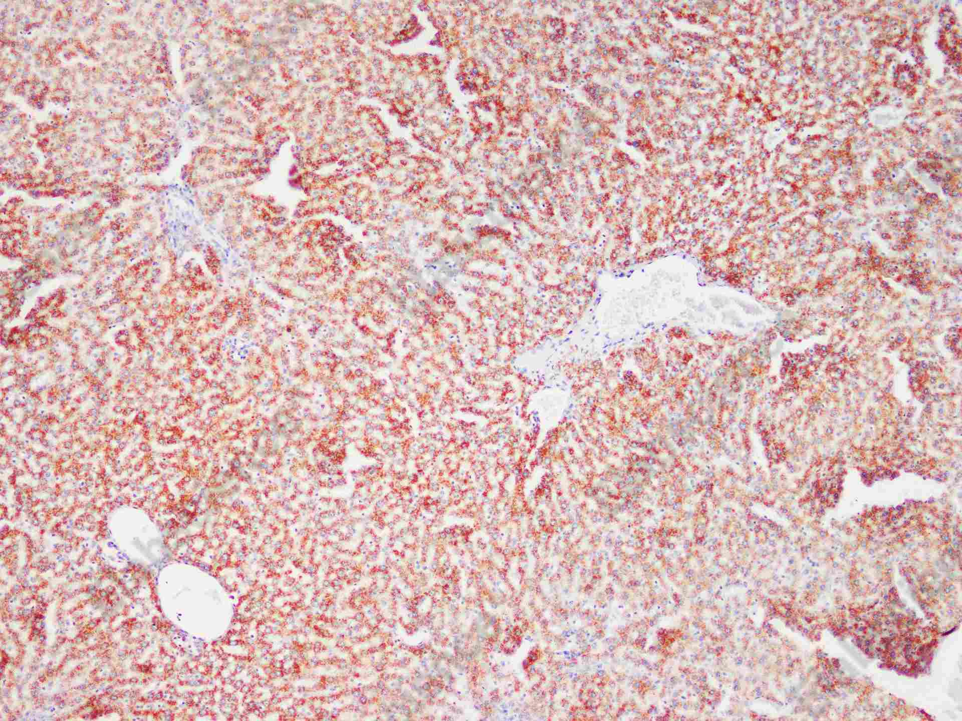 Recombinant ACOX1/AOX Monoclonal Antibody - 2