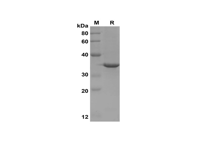 Recombinant Mouse IL-17A Protein(Sumo Tag)-1