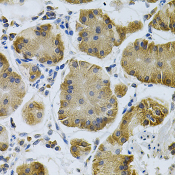 Immunohistochemistry of paraffin-embedded Human stomach using IGFBP4 Polyclonal Antibody at dilution of 1:100 (40x lens).