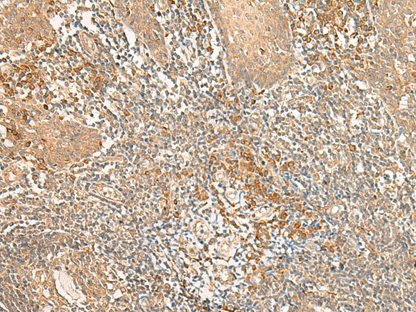 Immunohistochemistry of paraffin-embedded Human tonsil tissue  using WLS Polyclonal Antibody at dilution of 1:50(?200)