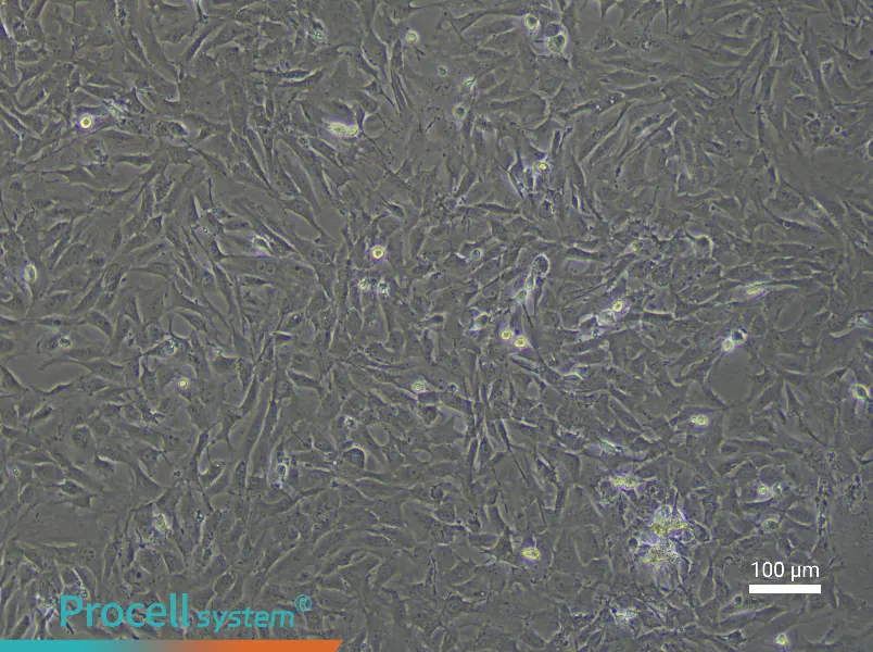 Rat Pulmonary Vascular Smooth Muscle Cell Complete Medium - 3