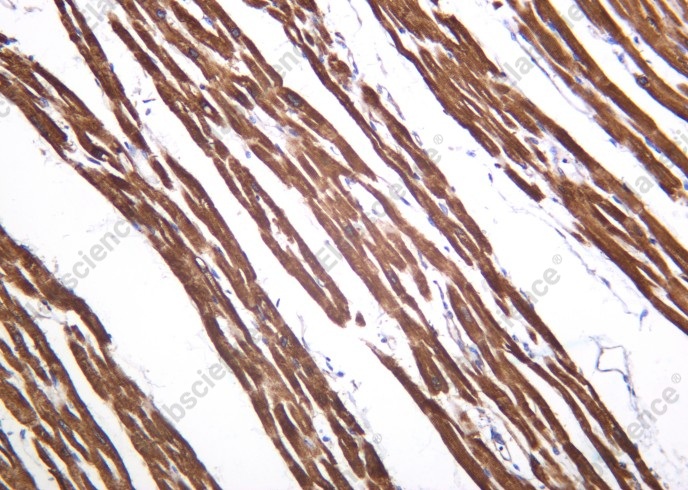 Recombinant SERCA2 Monoclonal Antibody - 1