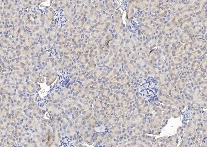 Recombinant Erythropoietin Monoclonal Antibody-searchlist-1