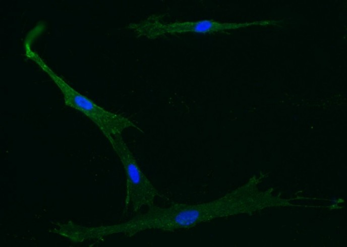 Recombinant Endoglin/CD105 Monoclonal Antibody - small - 2