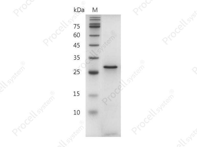 Galectin-3/LGALS3, Human, Recombinant