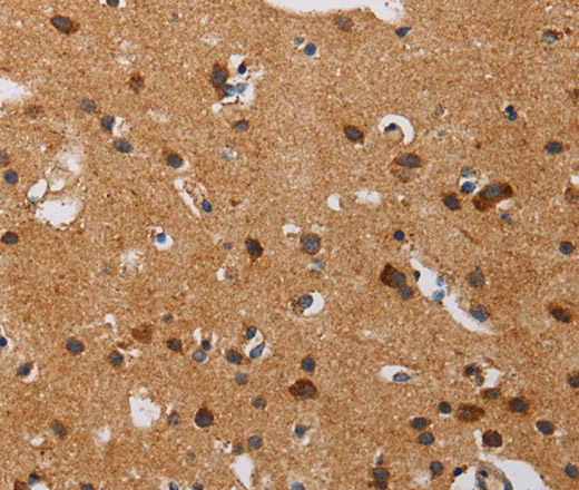 Immunohistochemistry of paraffin-embedded Human brain using IL17RA Polyclonal Antibody at dilution of 1:40